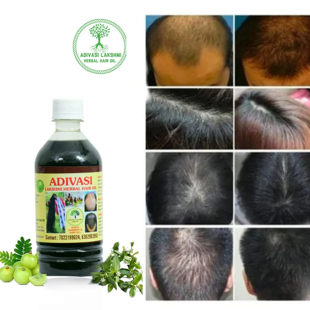 ADIVASI HERBAL NILAMBARI HAIR OIL! PACK OF 2 (BUY 1 GET 1 FREE)(4.9 ⭐⭐⭐⭐⭐ 93,830 REVIEWS) NEW - Image 7