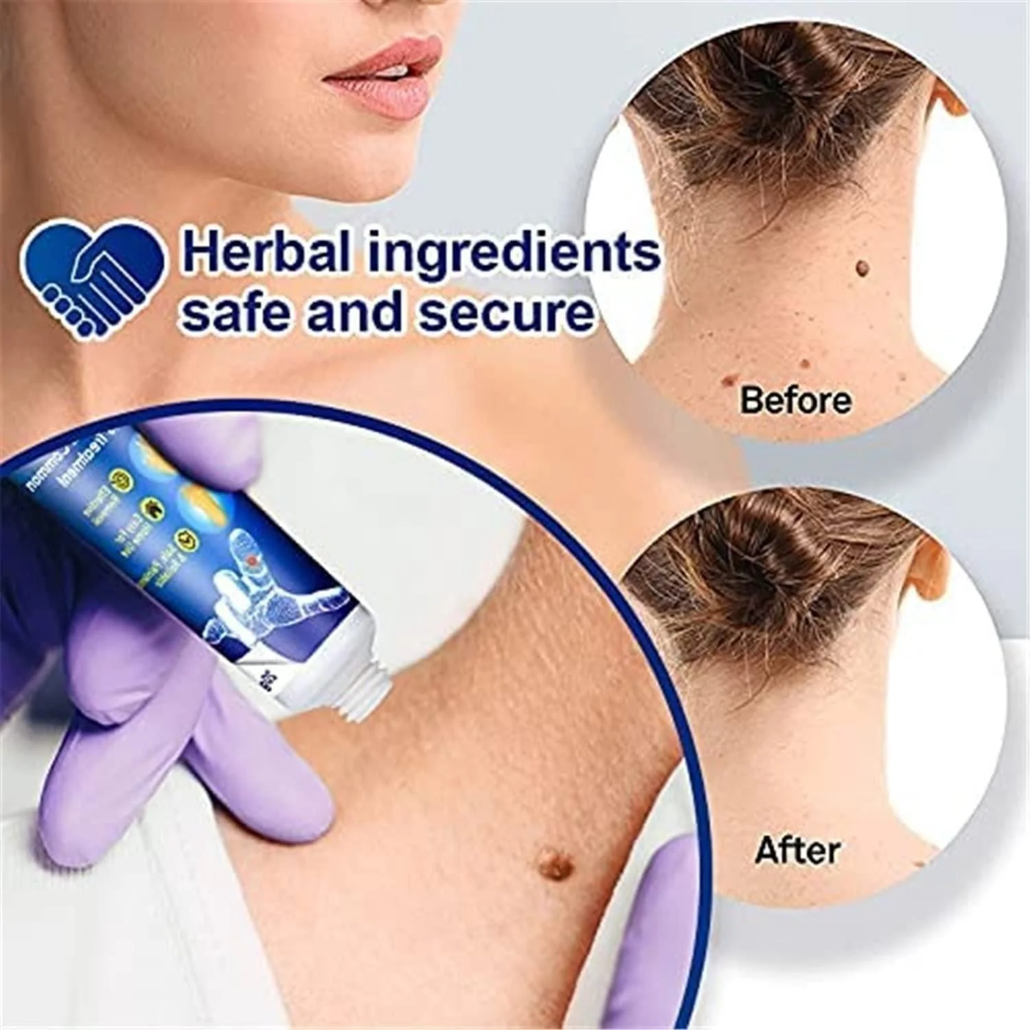 ATEMPORAL WARTS REMOVER CREAM ⭐️⭐️⭐️⭐️⭐️ (14758+ reviews) - Image 3