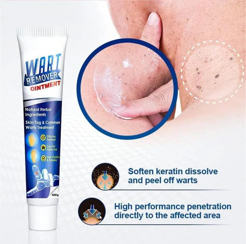 ATEMPORAL WARTS REMOVER CREAM ⭐️⭐️⭐️⭐️⭐️ (14758+ reviews) - Image 6