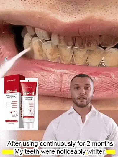 Intensive Teeth Whitening Toothpaste ( Buy 1 Get 1 Free ) - Image 6