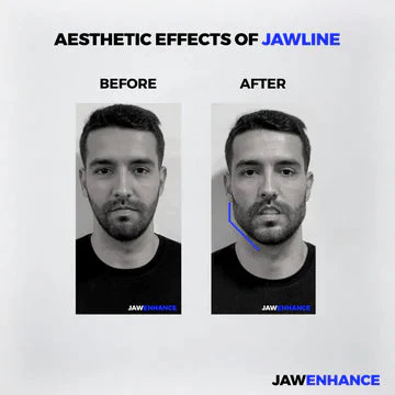 Jaw Enhance - Ultimate Facial Exerciser - Image 12