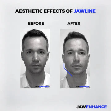 Jaw Enhance - Ultimate Facial Exerciser - Image 6