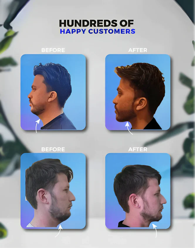 Jaw Enhance - Ultimate Facial Exerciser - Image 7