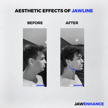 Jaw Enhance - Ultimate Facial Exerciser - Image 8